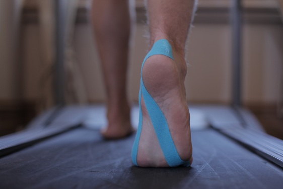 Blue Kinesio tape on walking foot for podiatry care